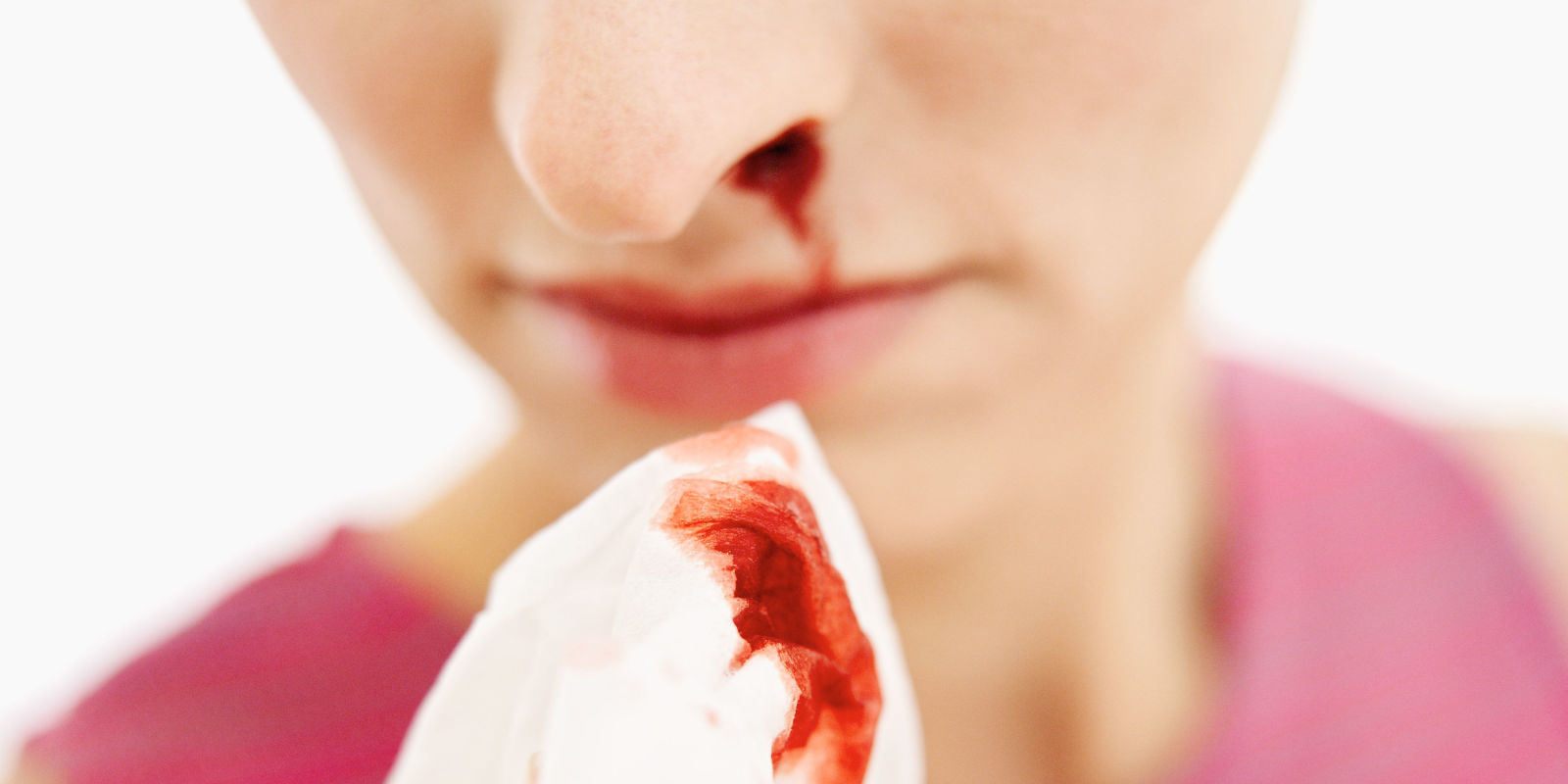 random nose bleed