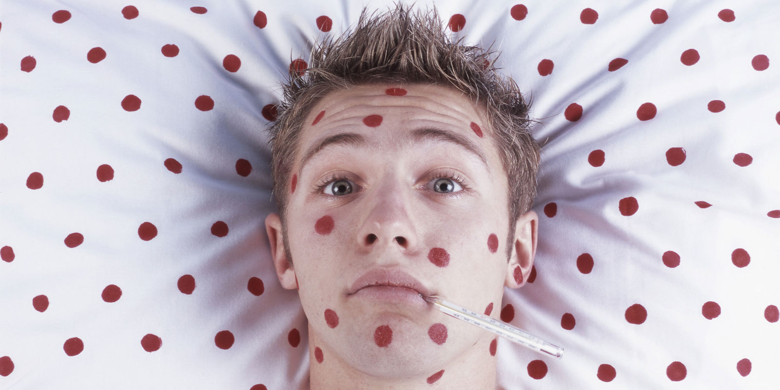 Measles: Symptoms, treatment and prevention